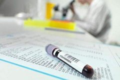 婚檢體格檢查主要內容是哪些？