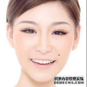 臉上痣的位置 不同位置有不同的寓意.png