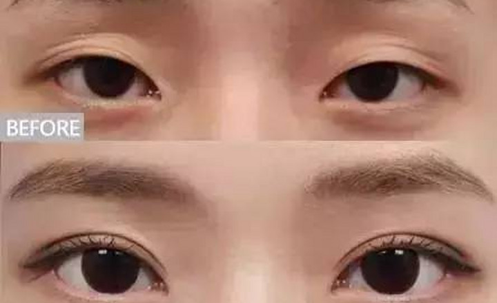 攻略: 化妝師必學專業技巧：遇到腫泡眼新娘千萬